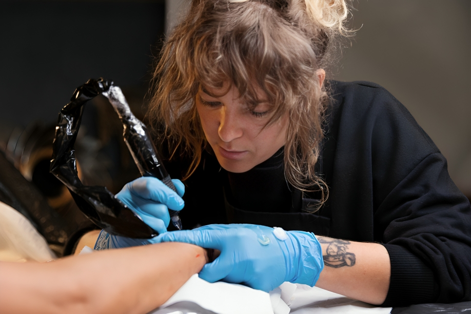 Is Laser Tattoo Removal Worth It?