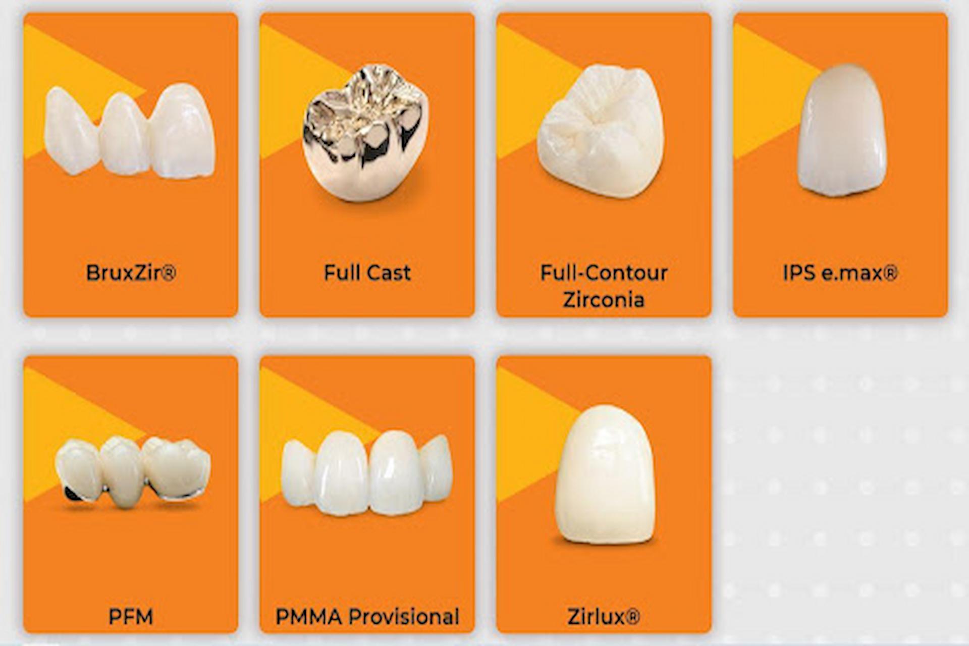 Ultimate Dental, Denture, Crown & Implants Lab Importance