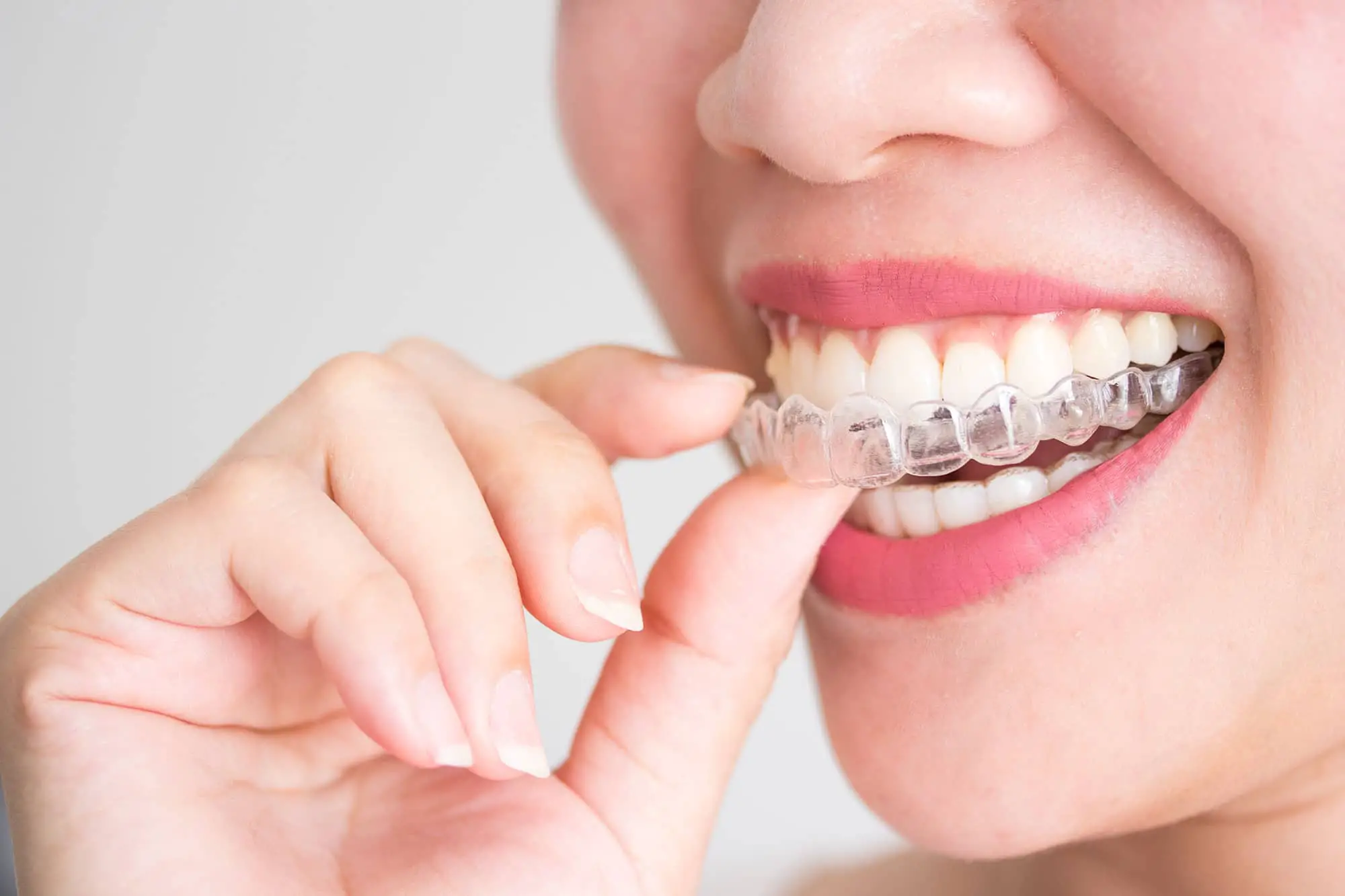 What Is The Need For Maintaining Great Dental Health