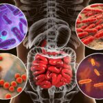 Gut Microbiome