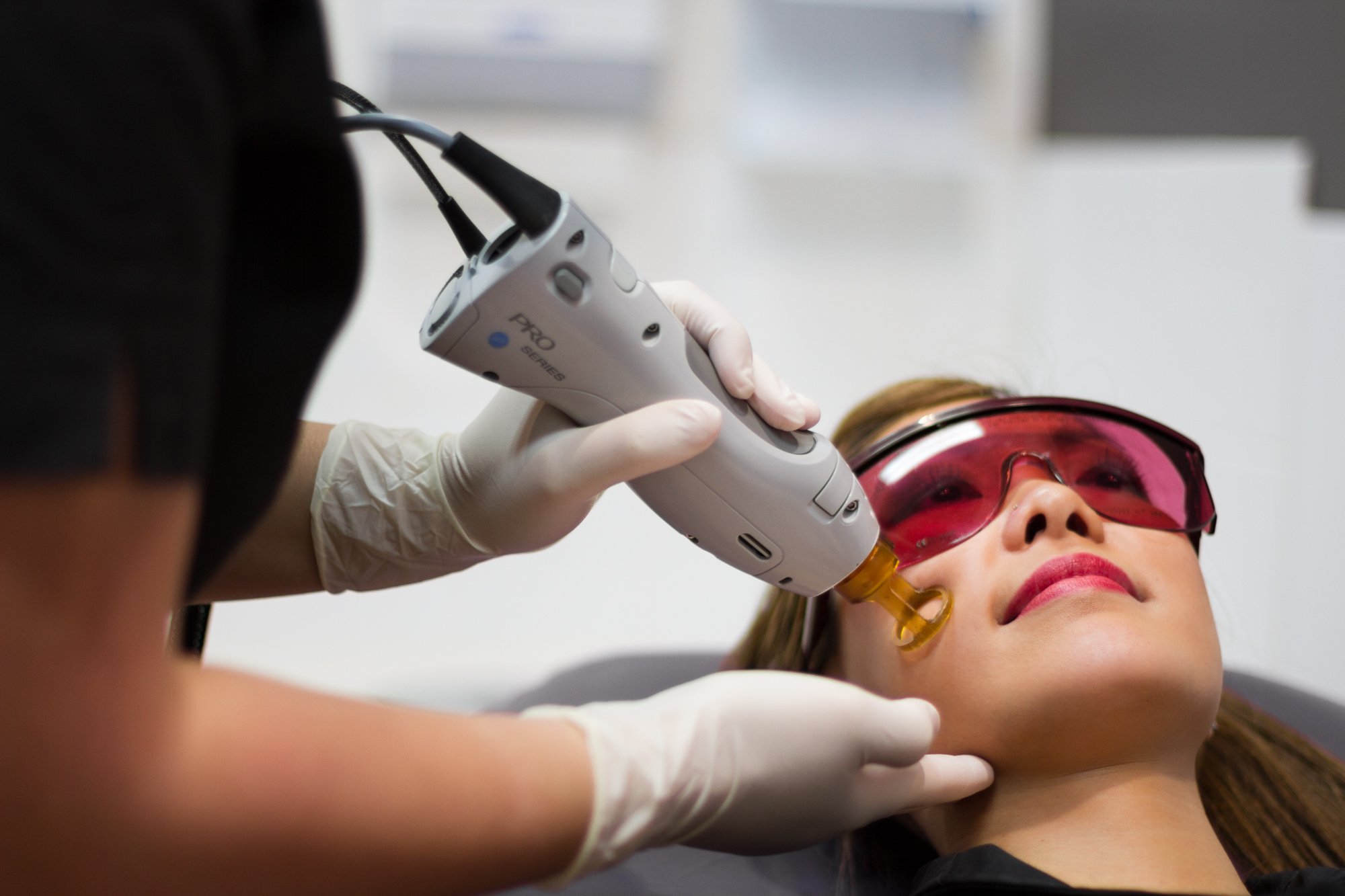 Laser Hair Removal – The Notable Side Effects